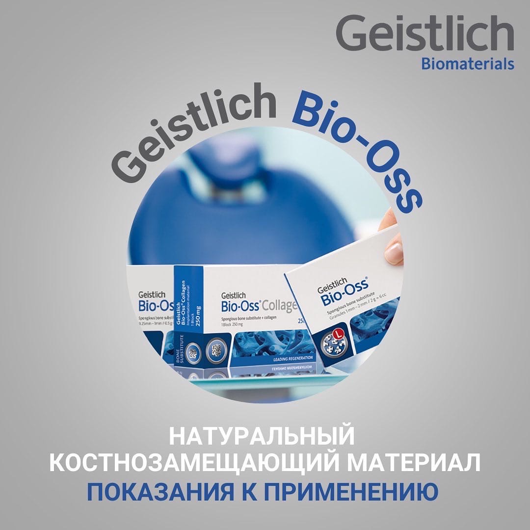 Костнозамещающие материалы Geistlich